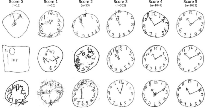 Il test dell'orologio (clock drawing test) - Dott.ssa Monica Ricci (Specialista Neuropsicologa, Phd Neuroscienze Cognitive)